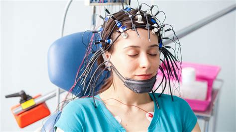 EEG and EMG NCV rates .